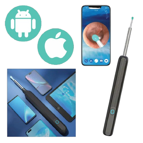 Ear Cleaner with Camera | Improved Hearing | Cleaner Ears | Reduced Tinnitus
